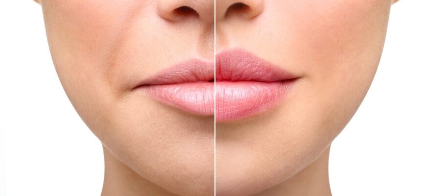 Як швидко зняти набряк статевих губ у домашніх умовах: ефективні методи