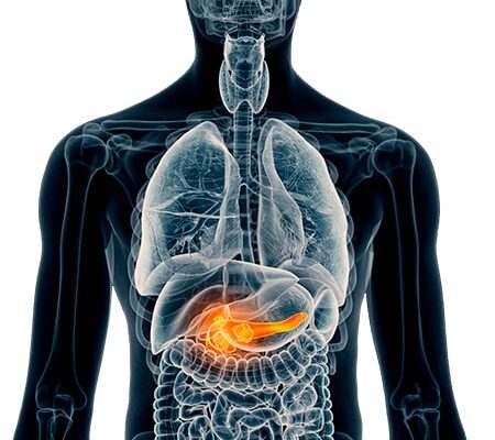 Як швидко зняти приступ підшлункової: ефективні методи та засоби