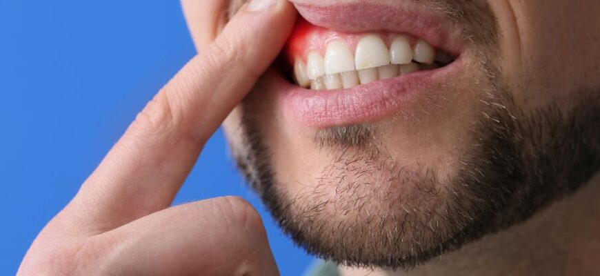 Як швидко зняти зубний біль в домашніх умовах: ефективні методи