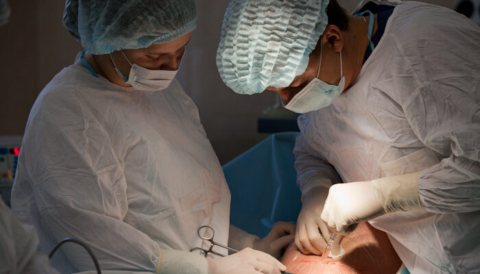 Як виглядає і загоюється шов після кесаревого розтину: детальний огляд