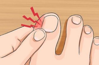 Як зменшити набряк після обрізання: корисні поради та методи лікування