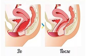 Як змінюється вигляд піхви після пологів: основні зміни та догляд