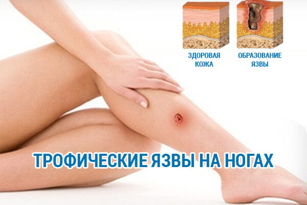 Як зняти біль у кісточці на нозі: народні методи лікування