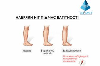 Як зняти набряки ніг при вагітності: поради та досвід з форумів