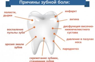 Як зняти зубний біль вагітним: дієві методи в домашніх умовах