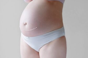 Заборони після кесаревого розтину: що не можна робити після операції?