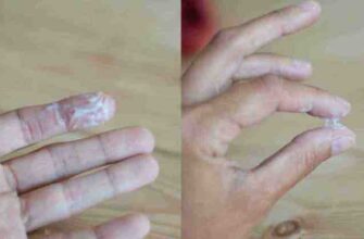 Затримка місячних: білі виділення та біль внизу живота – причини й рішення