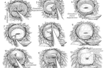 Заживлення шийки матки після конізації: етапи, поради та терміни