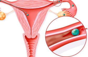 Жовті виділення після видалення матки: причини та лікування