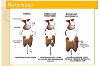 Життя після видалення щитовидки: реальні досвіди та поради з форуму