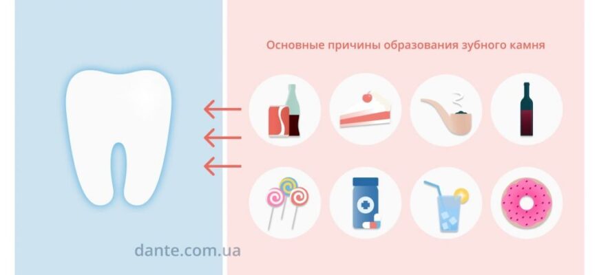 Зняття зубного каменю: ефективні методи і поради стоматологів