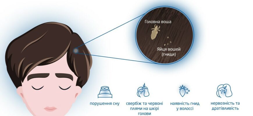 Звідки беруться воші у дітей: основні причини та способи зараження