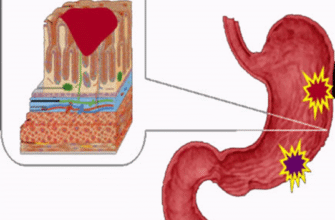 Біль в животі після їжі: можливі причини та ефективні рішення