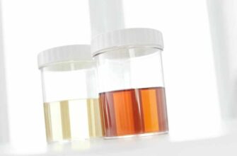 Чому сеча має неприємний запах: основні причини та що робити?