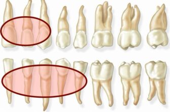 Чи боляче знімати шви: усе, що потрібно знати про процес і відчуття