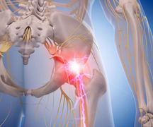 Чи дозволено робити масаж при защемленні нерва: поради та застереження Чи дозволено робити масаж при защемленні нерва: поради та застереження