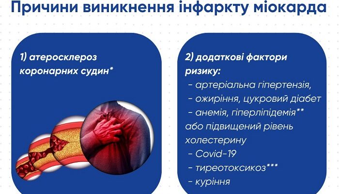 Чи дозволяється споживання меду після інфаркту: рекомендації та поради