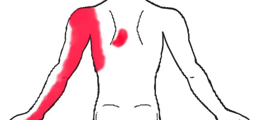 Чи може біль у спині віддавати в живіт: причини та рішення проблеми