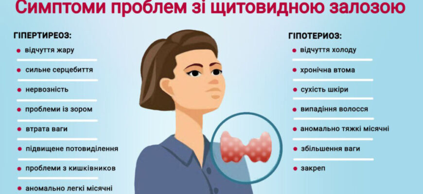 Чи може боліти щитовидка: ознаки, причини та шляхи лікування