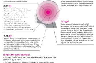 Чи можливе повернення до роботи після інсульту: поради й рекомендації