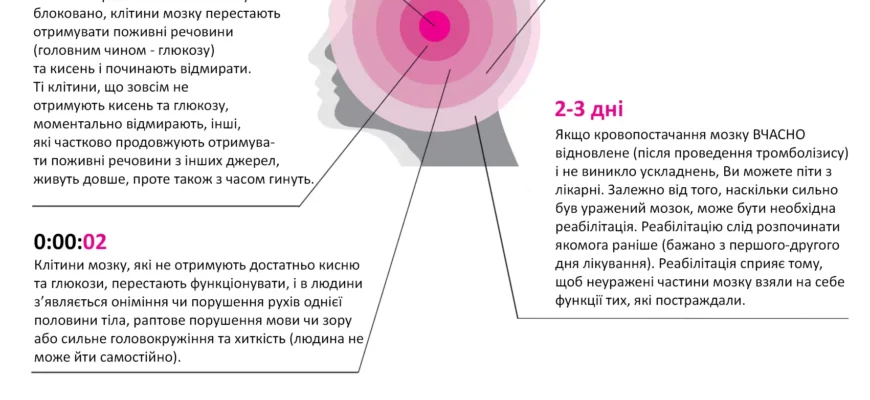 Чи можливе повернення до роботи після інсульту: поради й рекомендації