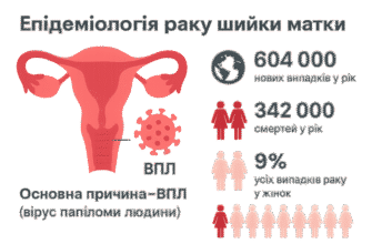 Чи можливо діагностувати рак за допомогою аналізу крові? Відповіді та факти.