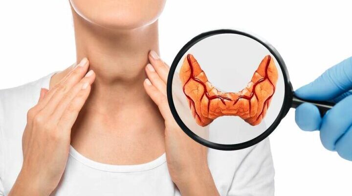 Чи можливо повністю вилікувати аутоімунний тиреоїдит: сучасний погляд