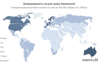 Чи можна померти, зірвавши родимку: факти та міфи про небезпеку