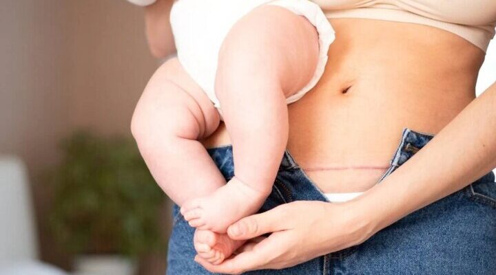 Чи можуть розійтися шви після операції: причини та профілактика