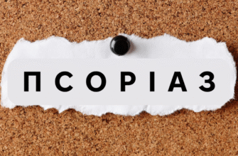 Чи Передається Псоріаз: Вивчаємо Причини та Міфи Захворювання