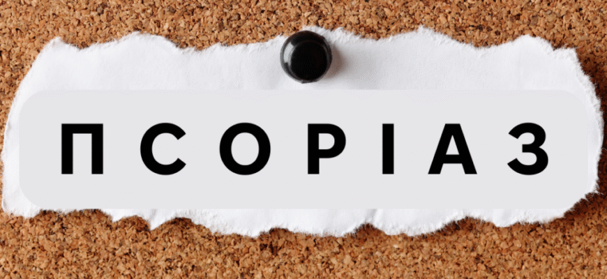 Чи Передається Псоріаз: Вивчаємо Причини та Міфи Захворювання