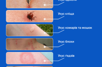 Чи варто приймати антибіотик після укусу кліща: поради та рекомендації