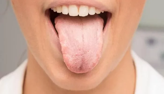 До чого сняться голки в роті: тлумачення та значення сну