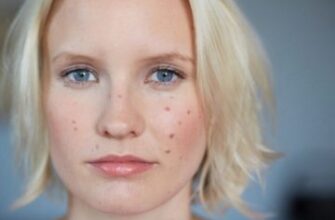 До чого сняться прищі на тілі: тлумачення та значення сновидінь