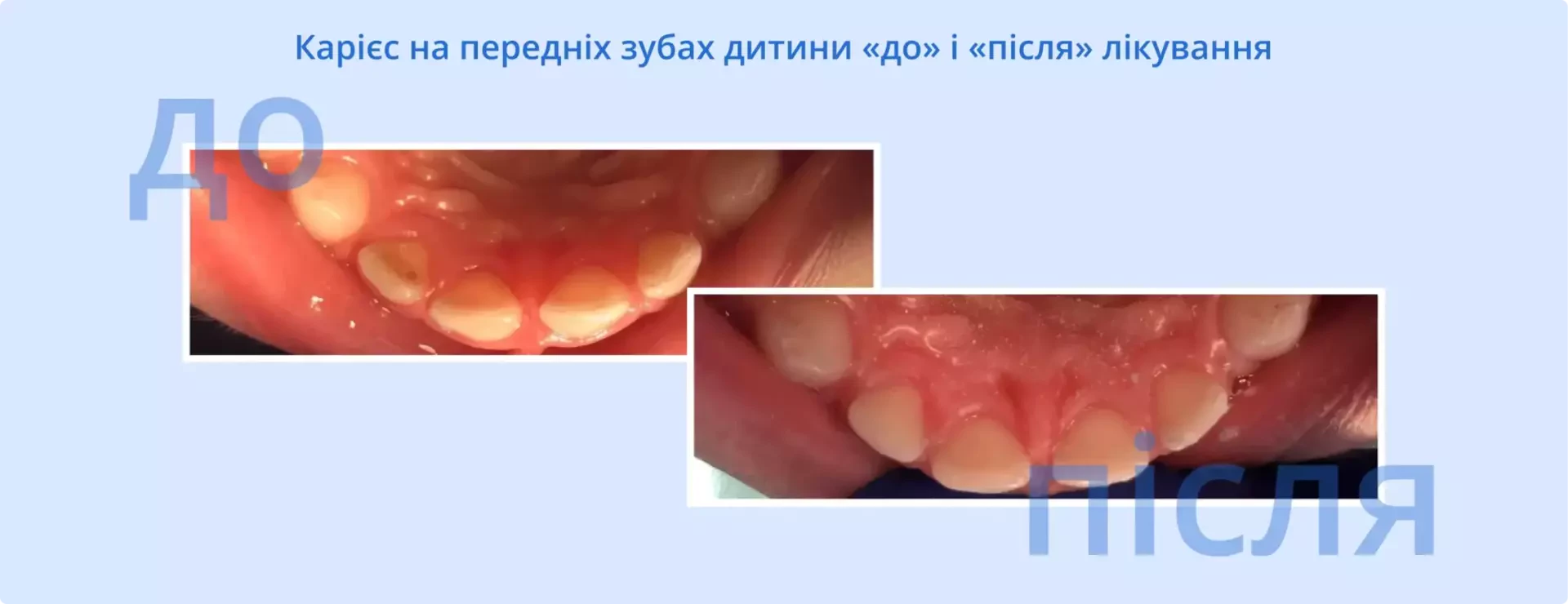 Сонник зуби: до чого сняться гнилі, золоті, вставні, здорові ...