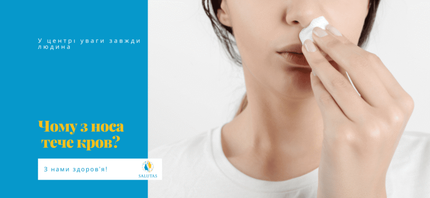 До чого сниться кров з носа: значення та тлумачення сновидіння