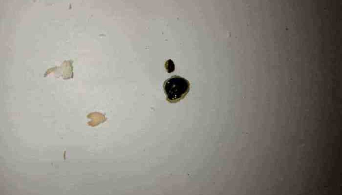 До чого сниться свій кал: значення сну та його психологічний аспект