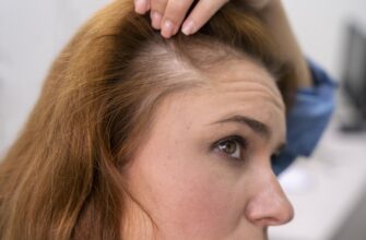 Ефективні методи лікування алопеції у дітей: що працює?