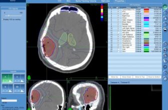 Гліобластома: Чи Існують Реальні Шанси на Одужання? Інформація та Досвід