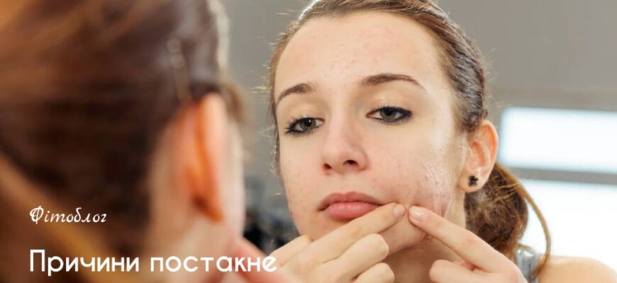 Інфільтрат після ін’єкції: причини, симптоми та методи лікування