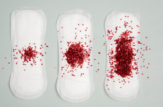 Кров’яні виділення після місячних: причини та способи лікування