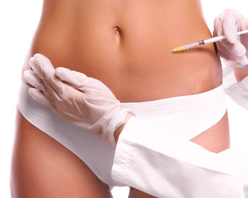 Ліполітики: ефекти до і після процедур для ідеального тіла