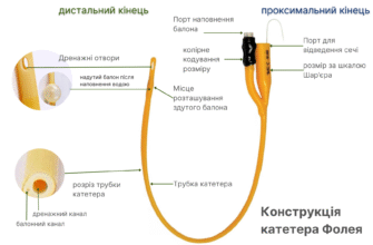 Можливі ускладнення після катетеризації сечового міхура: назви та наслідки