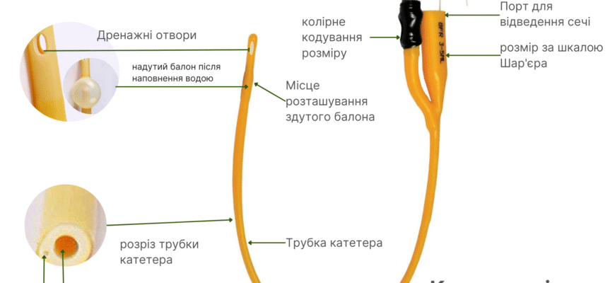 Можливі ускладнення після катетеризації сечового міхура: назви та наслідки
