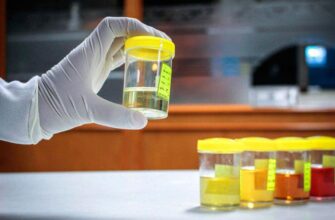 Оптимальний колір сечі: який відтінок вважається нормою?