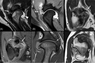Що краще: КТ чи МРТ? Порівняння методів діагностики для пацієнта