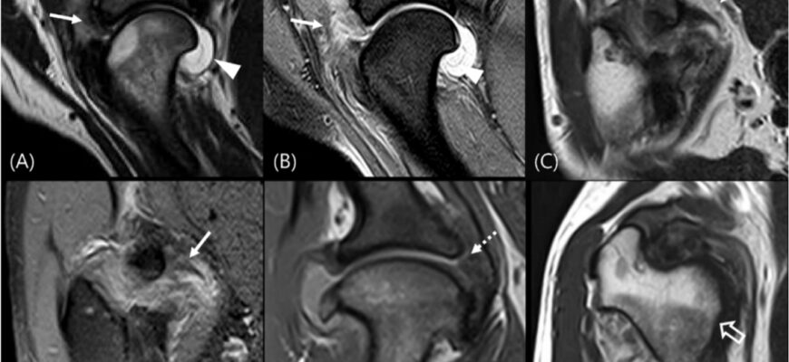 Що краще: КТ чи МРТ? Порівняння методів діагностики для пацієнта