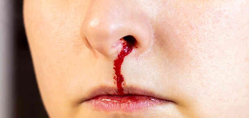 Що означає, коли сниться кров з носа: тлумачення і значення сну