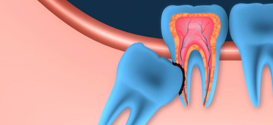 Що означає, коли сниться, що випадають зуби: розкриваємо таємниці сновидінь