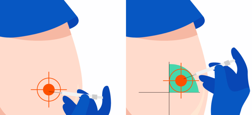 Що робити, якщо після уколу нога болить: поради та рекомендації